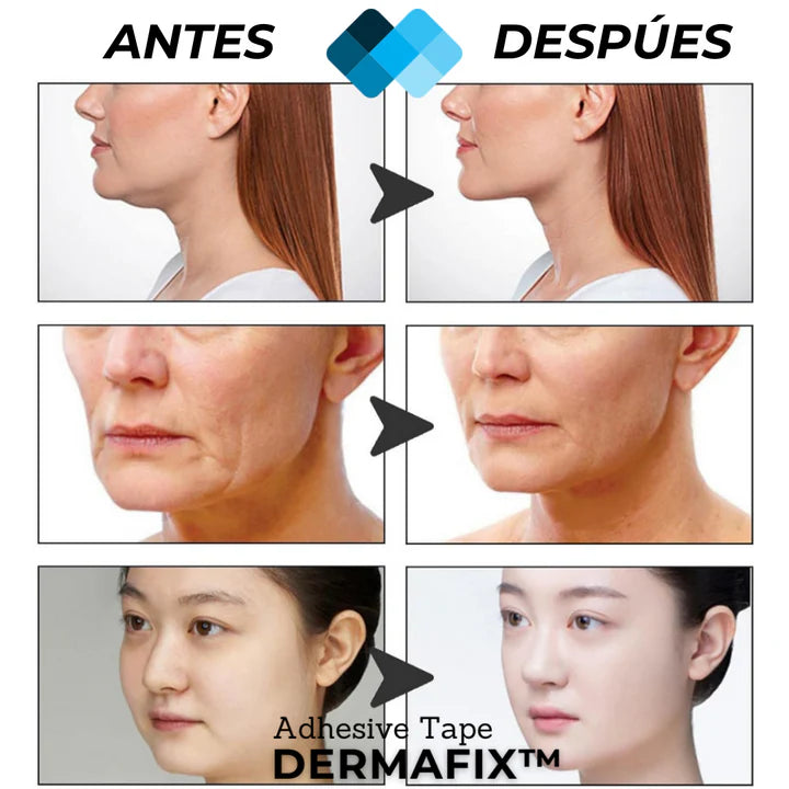 Lifting Facial
